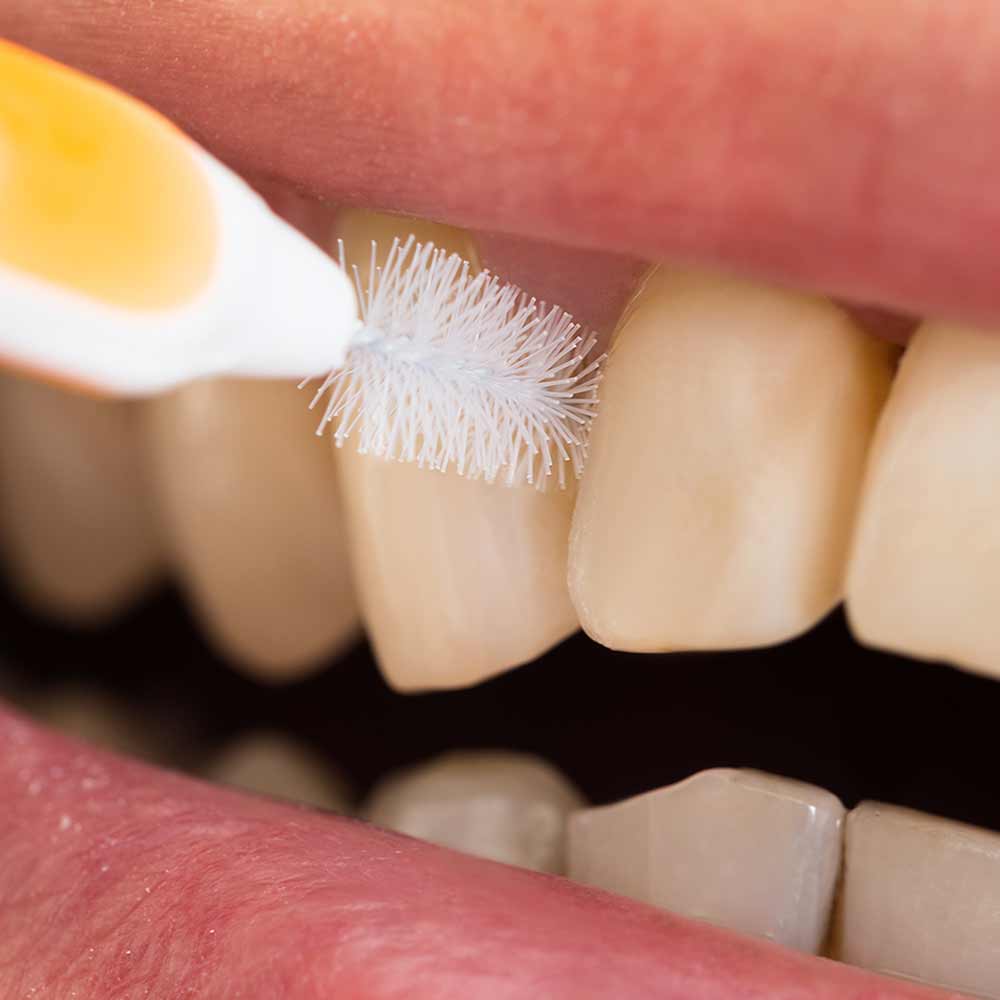 Cleans his teeth. The 10 worst Behaviors for your Teeth Philadelphia Cosmetic.