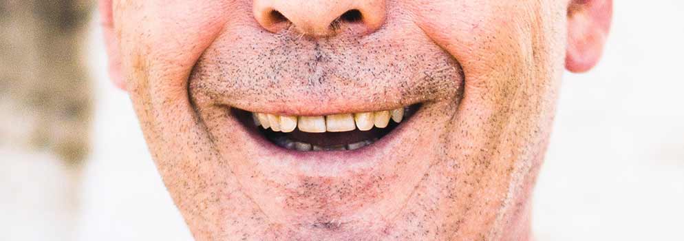 quanto custam as dentaduras (e quais são as melhores?) 6